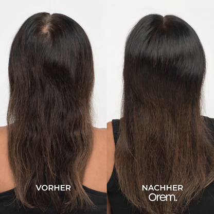 Kürbiskern-Softgels — Natürlicher Anti-DHT-Wirkstoff